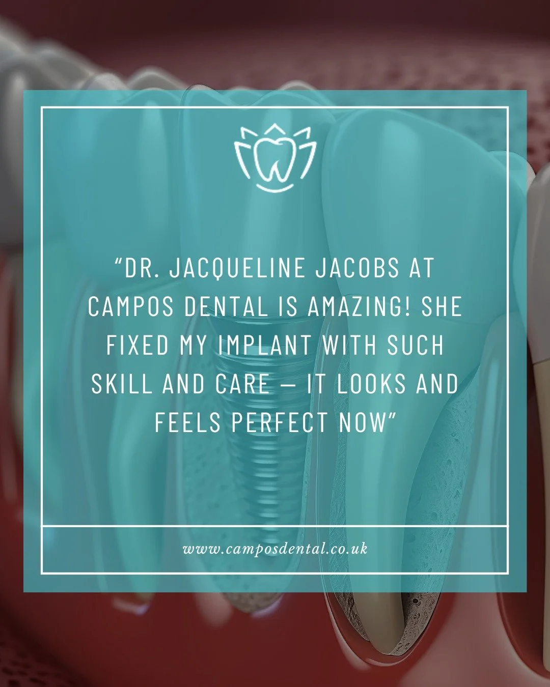 🦷🦷🦷🦷🦷

Looking for a reliable solution for missing teeth? Our patients trust Campos Dental for high-quality dental implants - and reviews speak for themselves:

&quot;Dr. Jacqueline Jacobs at Campos Dental is amazing! She fixed my implant with s