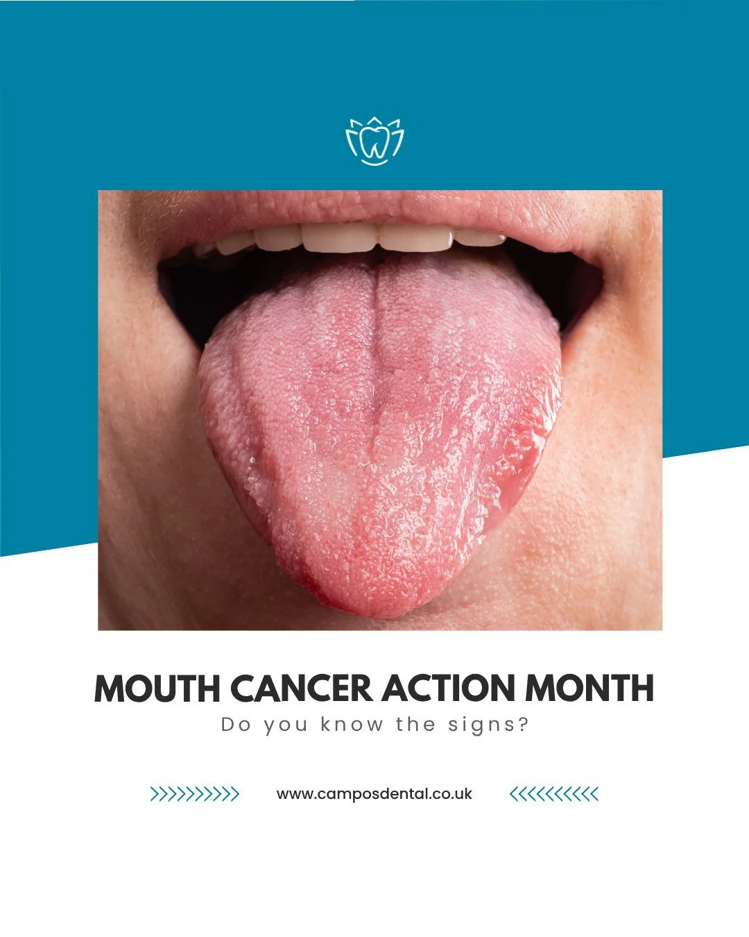 At Campos Dental, we take oral health seriously. Mouth cancer is uncommon, but early detection is important &mdash; and your dentist is trained to spot changes that might be easy to miss.

⚠️ Things to be aware of:
&bull; Sores or ulcers that don&rsq