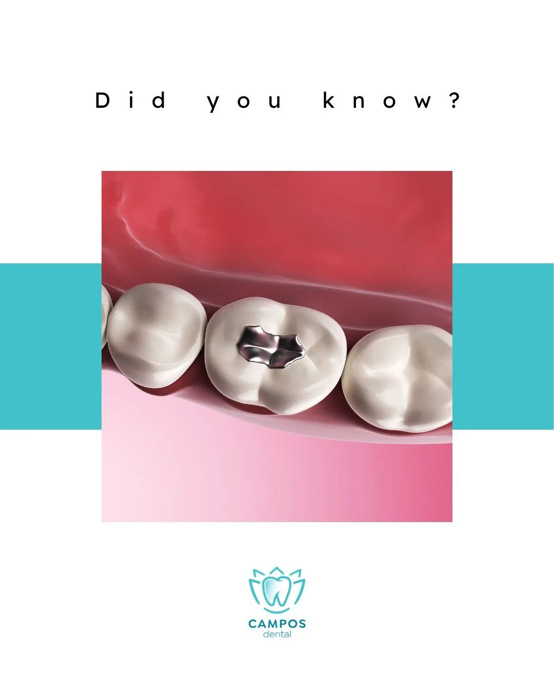 Mercury fillings are being phased out worldwide by 2034 - but at Campos Dental, we&rsquo;ll make sure your smile stays safe and healthy.

Here&rsquo;s what you should know:
&bull; We offer modern, mercury-free filling options.
&bull; Don&rsquo;t remo