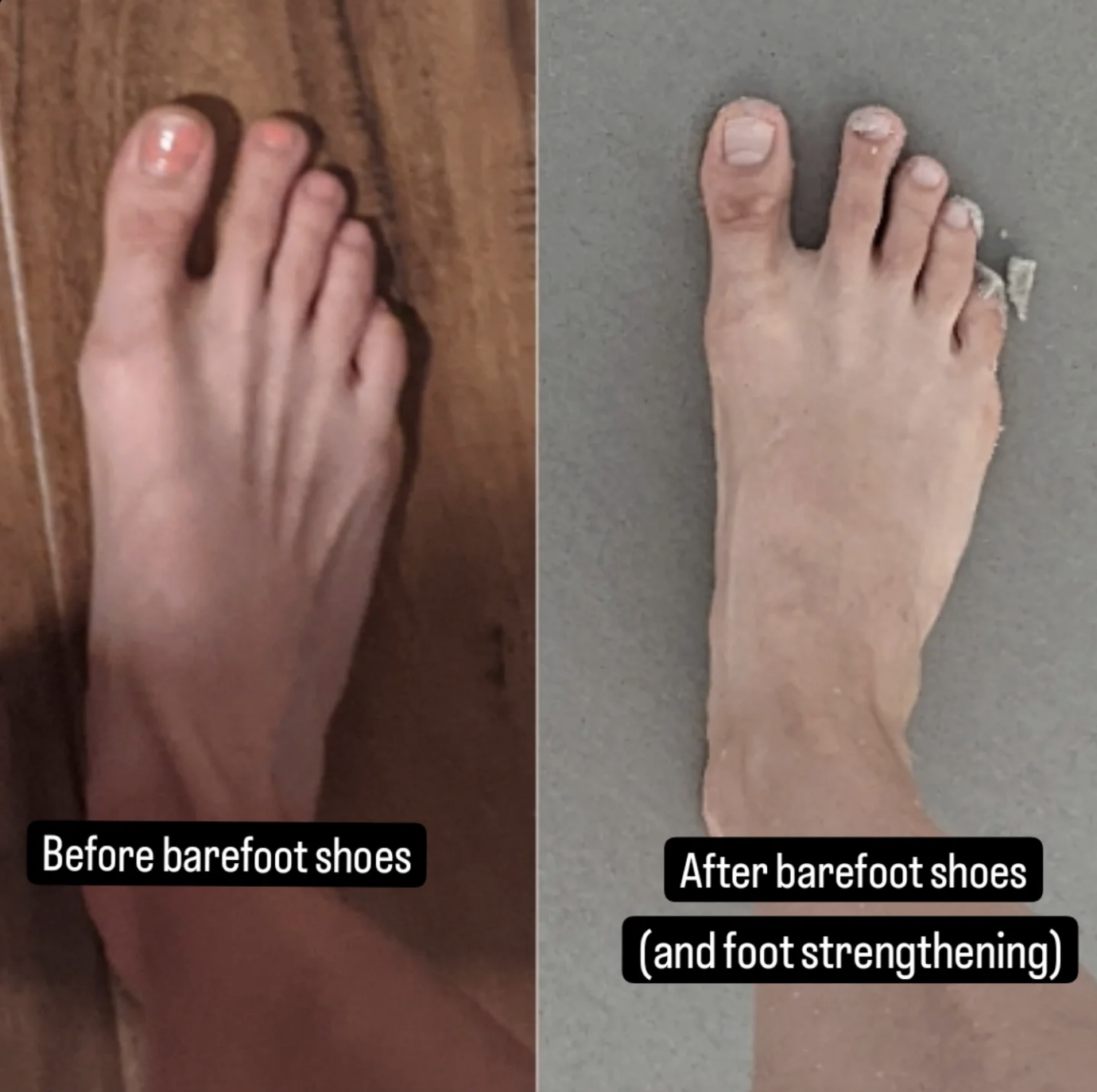 Barefoot shoe transition - feet comparison