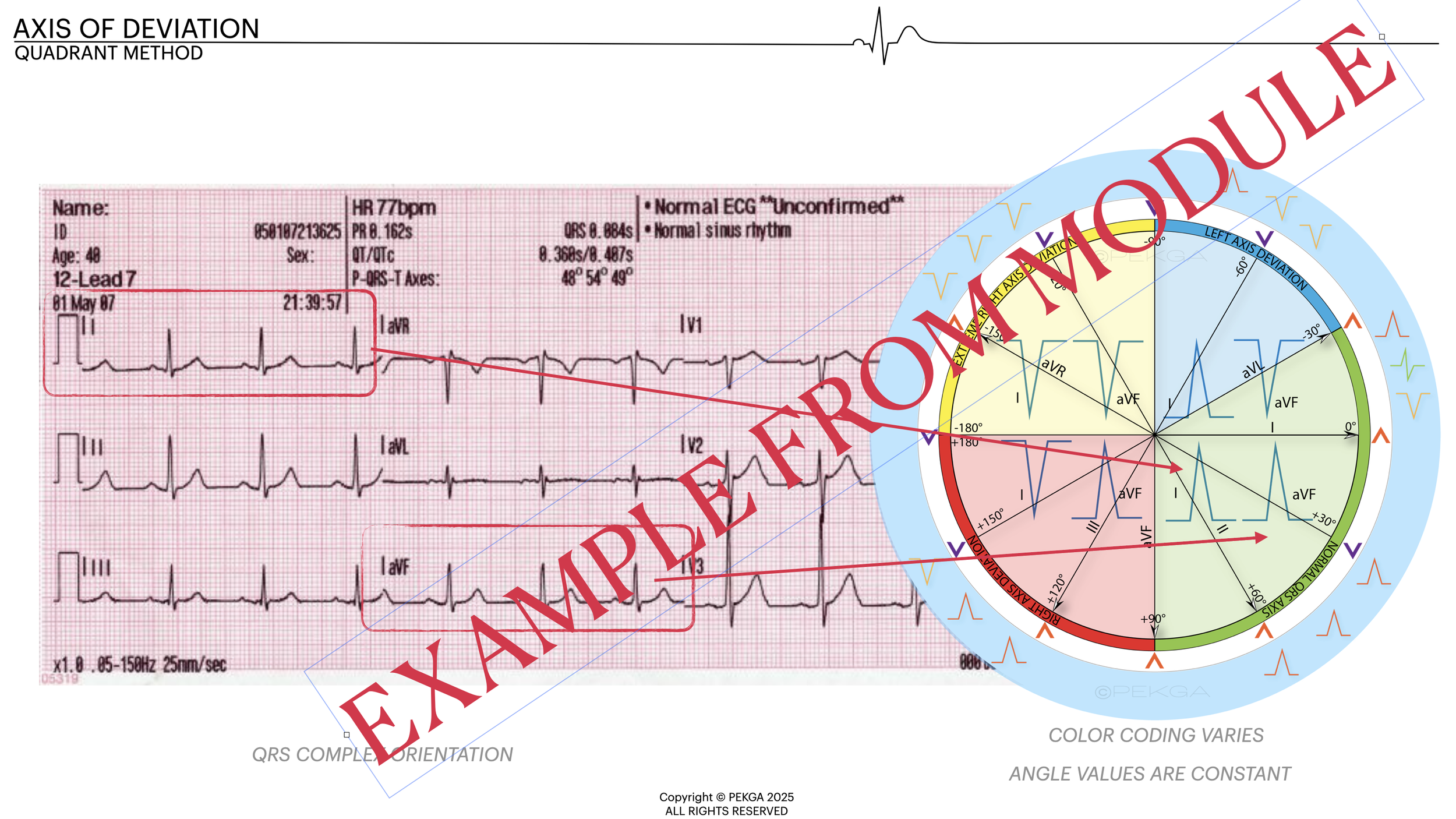 An electrocardiogram (ECG) printout with a color-coded circular diagram illustrating the heart's electrical activity, including axes of deviation, and a large red overlay stating 'EXAMPLE FOR DEMONSTRATION'.