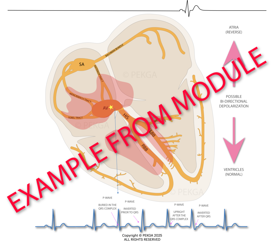 ECG, EKG, MASTER ECG, CCT/CRAT PREP, ECG COURSE