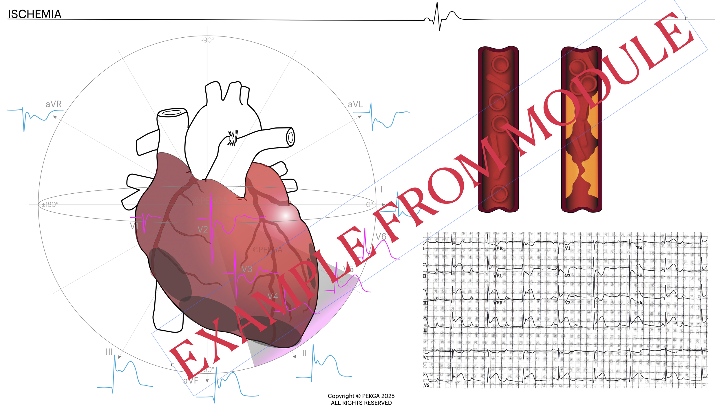 Illustration of a human heart with overlaid EKG and artery images, the word 'EXPLAIN FROM MYDULE' in large red text.