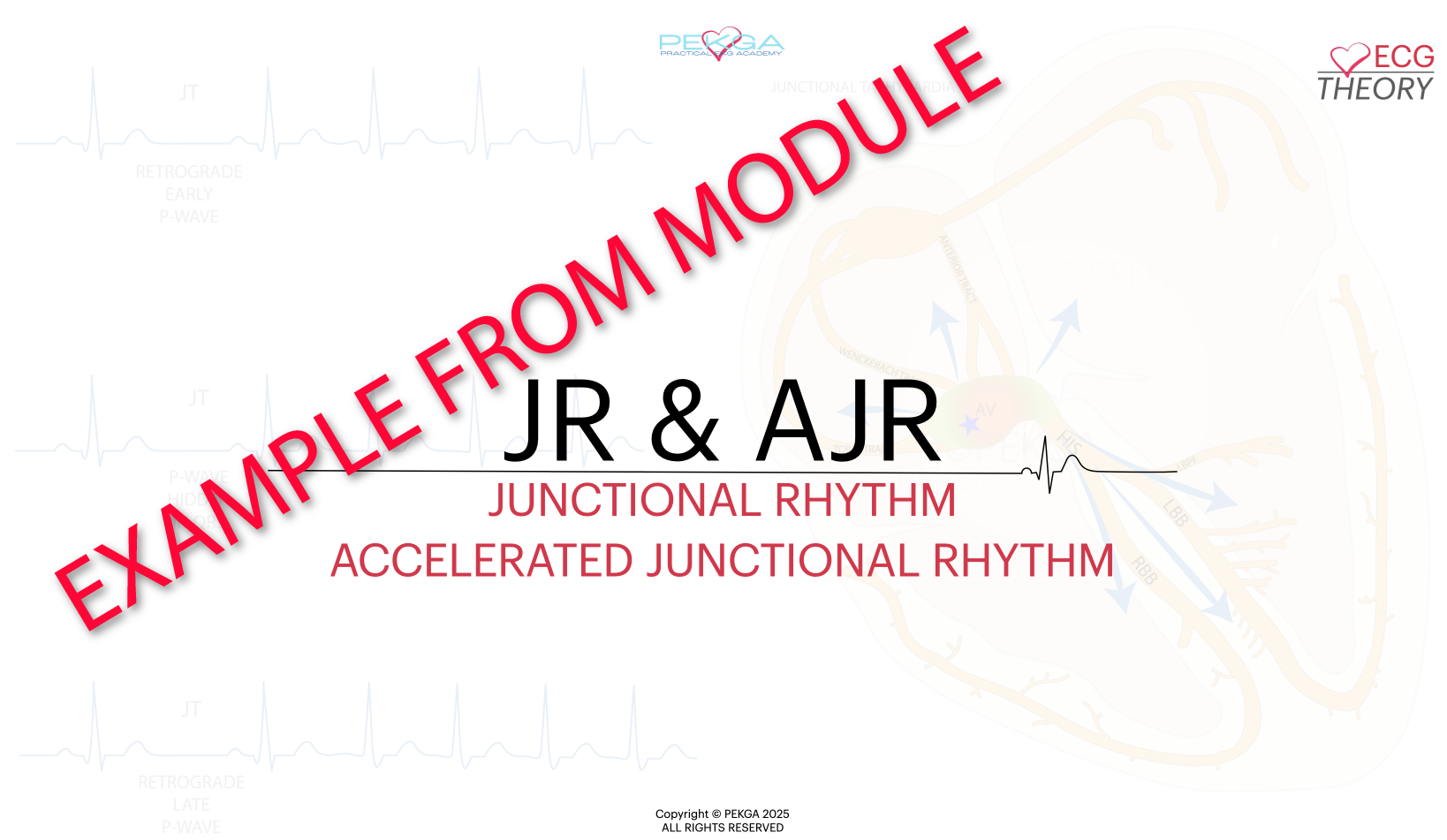 ECG, EKG, MASTER ECG, CCT/CRAT PREP, ECG COURSE