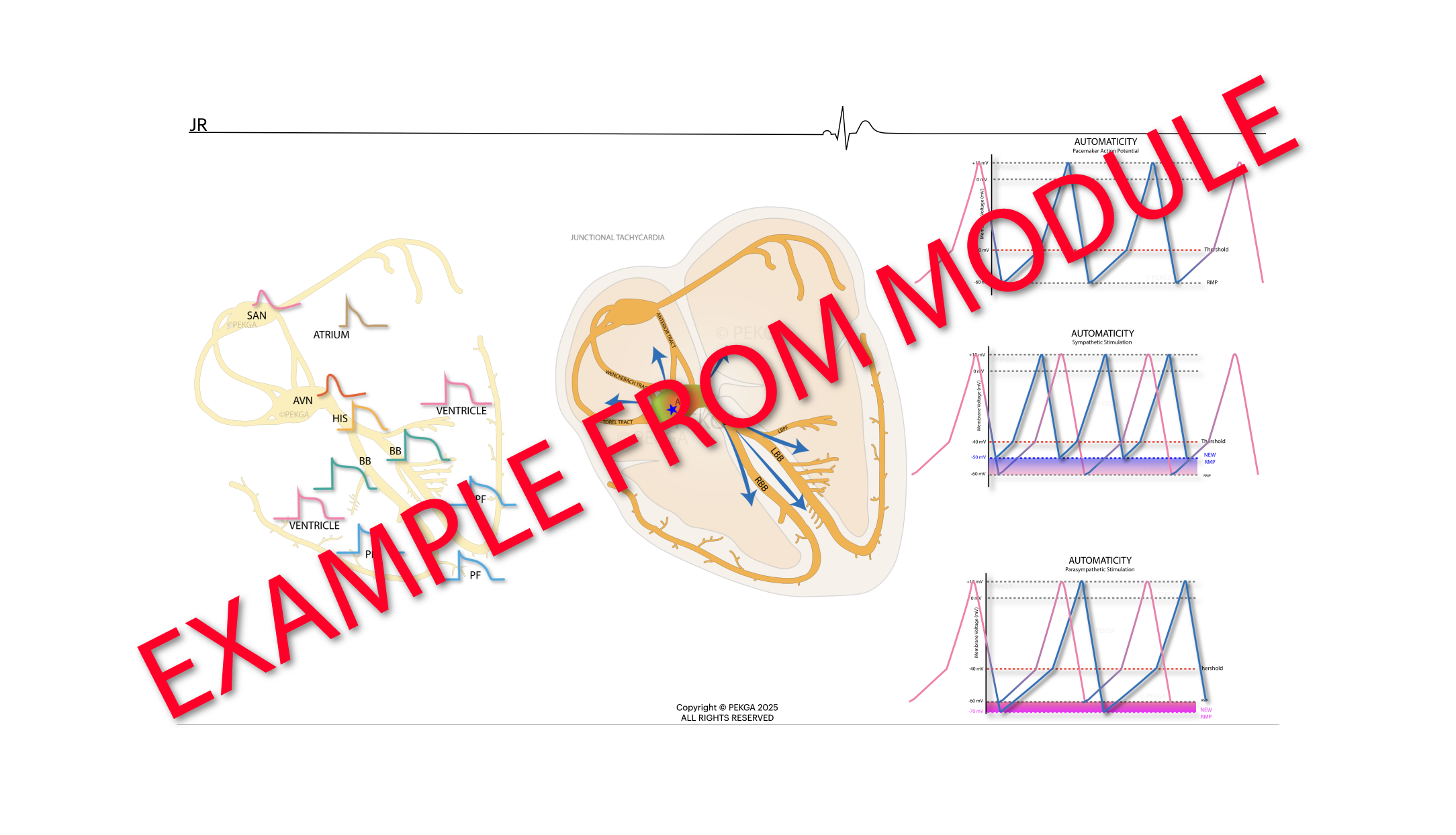 Illustration of a heart's electrical conduction system showing the sinoatrial node, atrioventricular node, bundle of His, and Purkinje fibers, with graphs comparing automaticity in pacemaker and sympathetic and parasympathetic stimulation.