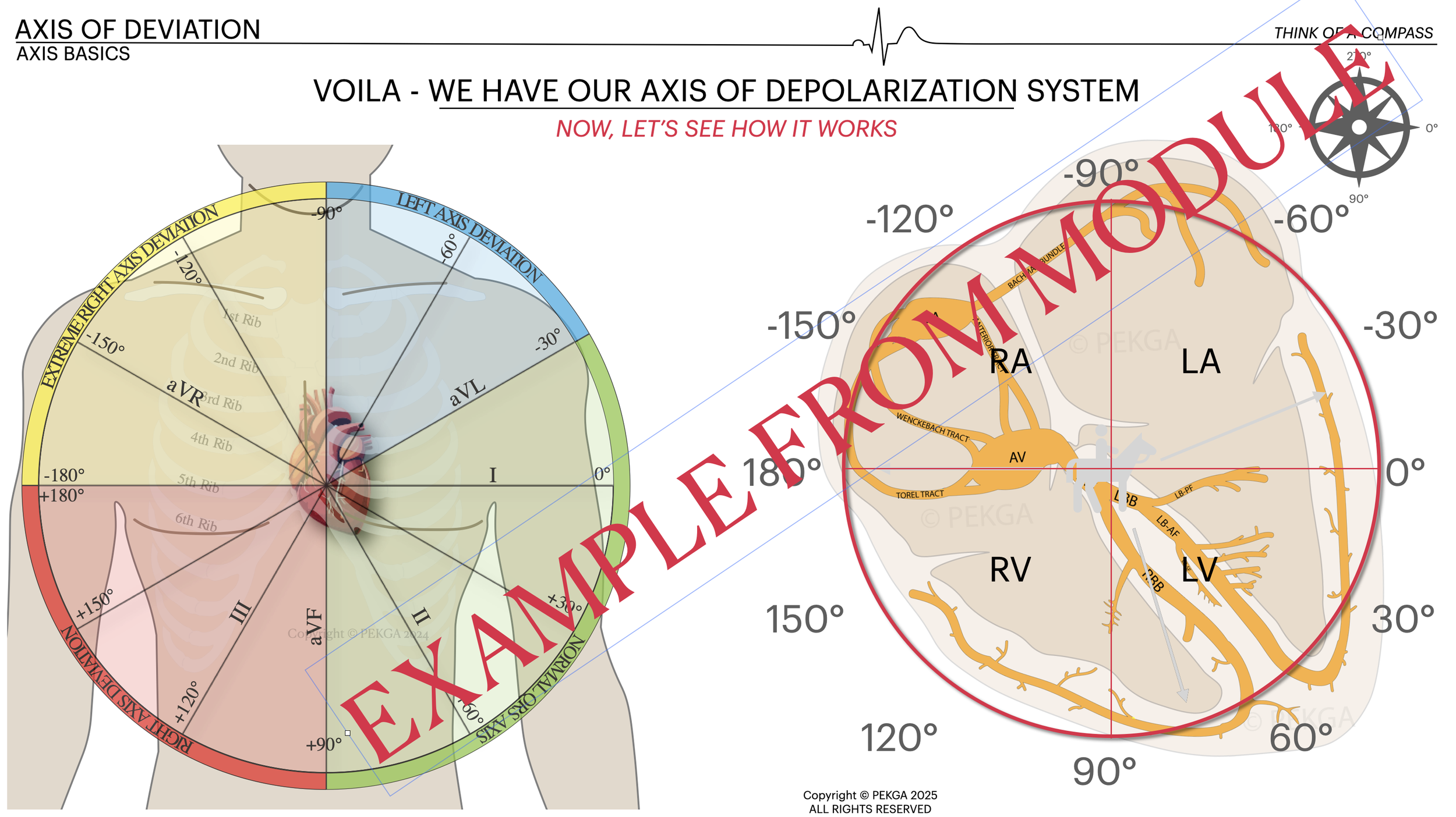 Diagram of the human heart with annotations on the heart's electrical conduction system, showing axial deviations and pathways of the heart's nerves and tracts, overlaid with a large red text 'EXAMPLE - CONFIDENTIAL'.