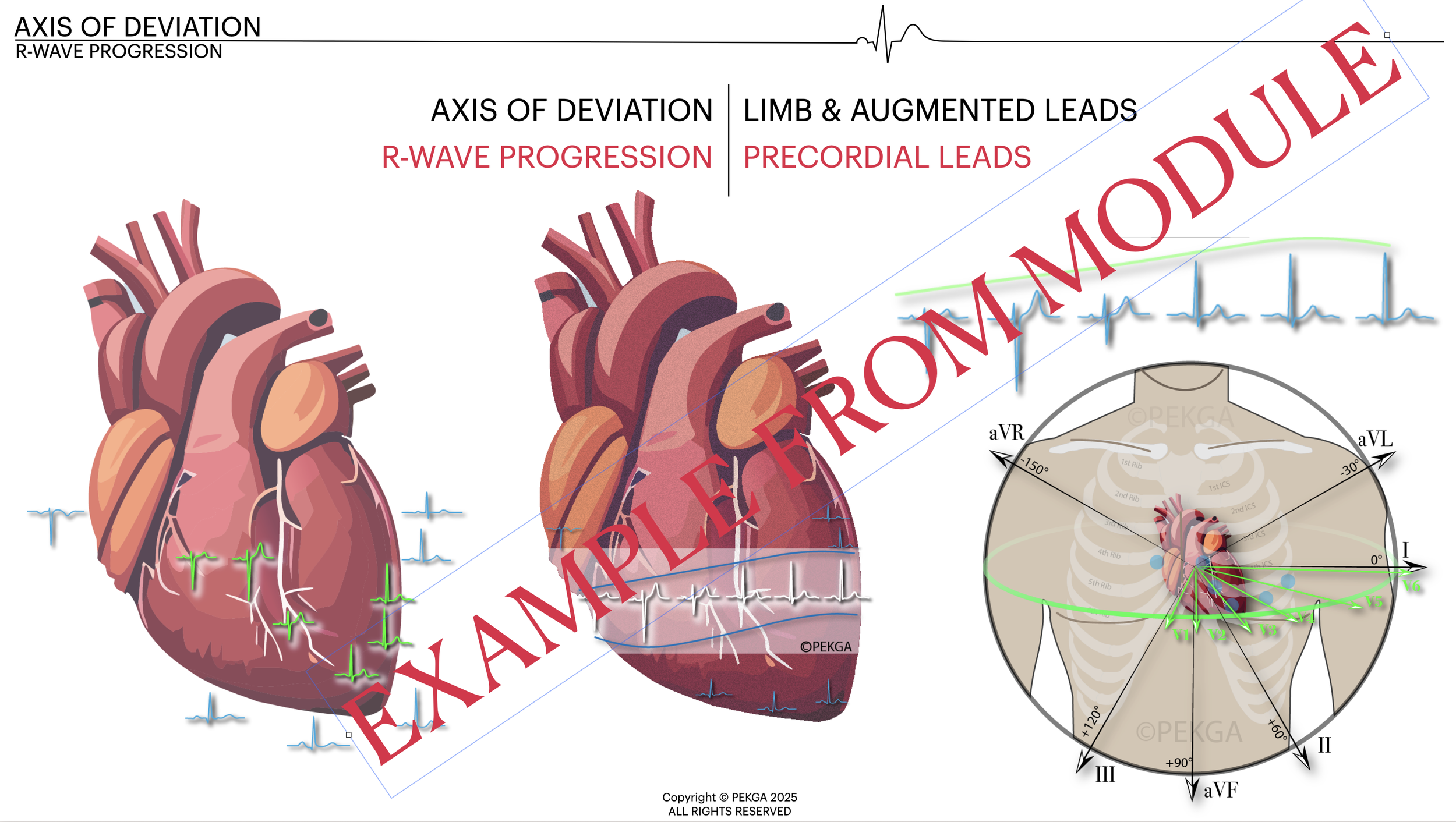 Diagram of the heart showing electrical activity on an electrocardiogram (ECG), indicating axis deviation, R-wave progression, limb and augmented leads, with the heart's anatomy and ECG vectors, marked with labels and a red "EXAMINATION PROBLEM" wate