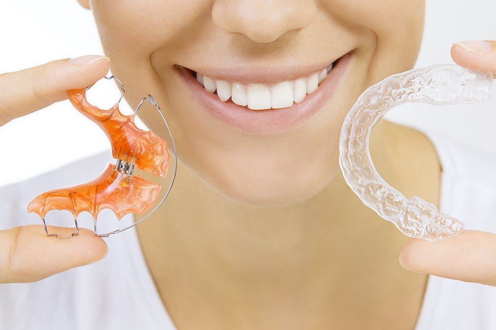 permanent-and-removable-retainers-56159139-2.jpeg