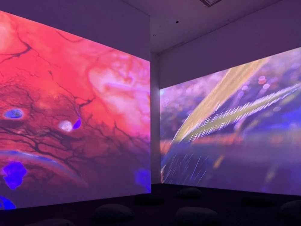 Worry Will Vanish @MFAH