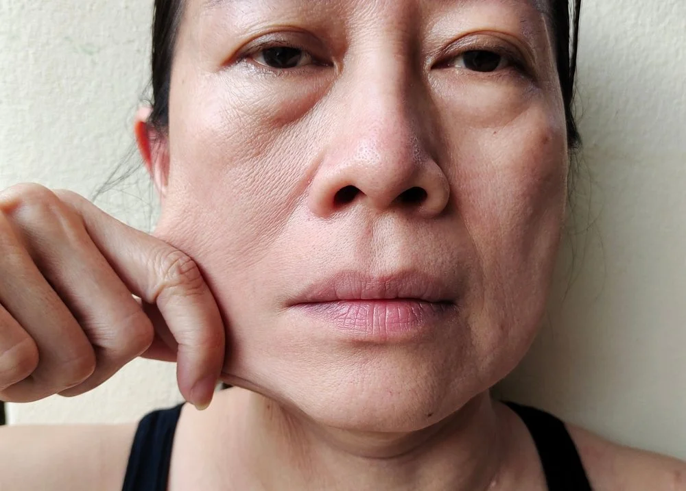 How Can Ultherapy Rejuvenate Your Skin?