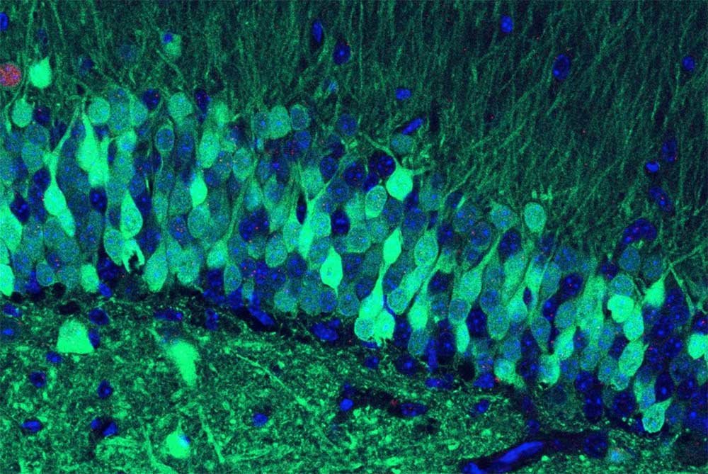How memories look in our brain