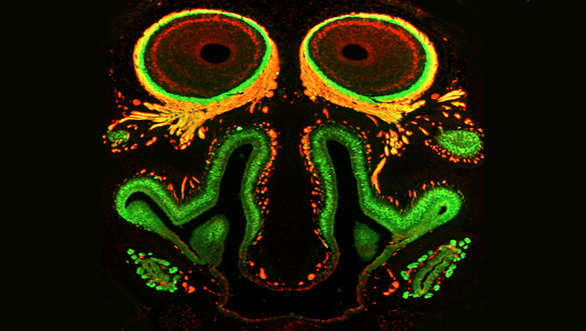 Memories in our brain