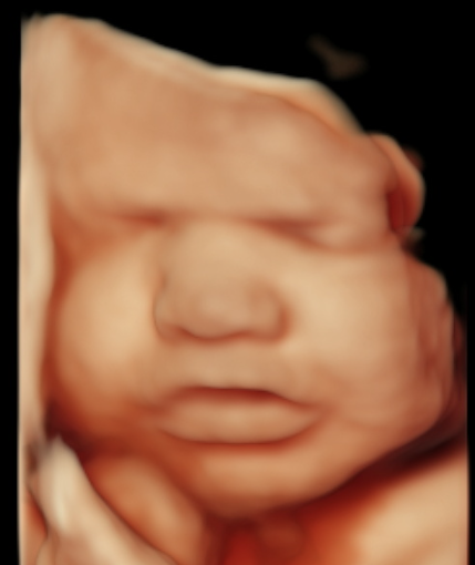 When Is the Best Time to Book a Pregnancy Ultrasound?
