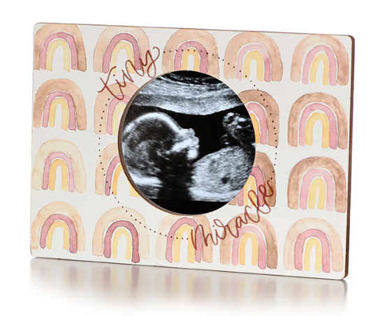 Magnetic Ultrasound Frame
