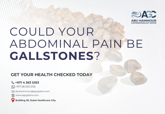 Could Your Abdominal Pain Be Gallstones?