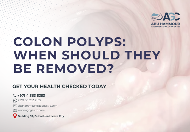 Colon Polyps: When Should They Be Removed?