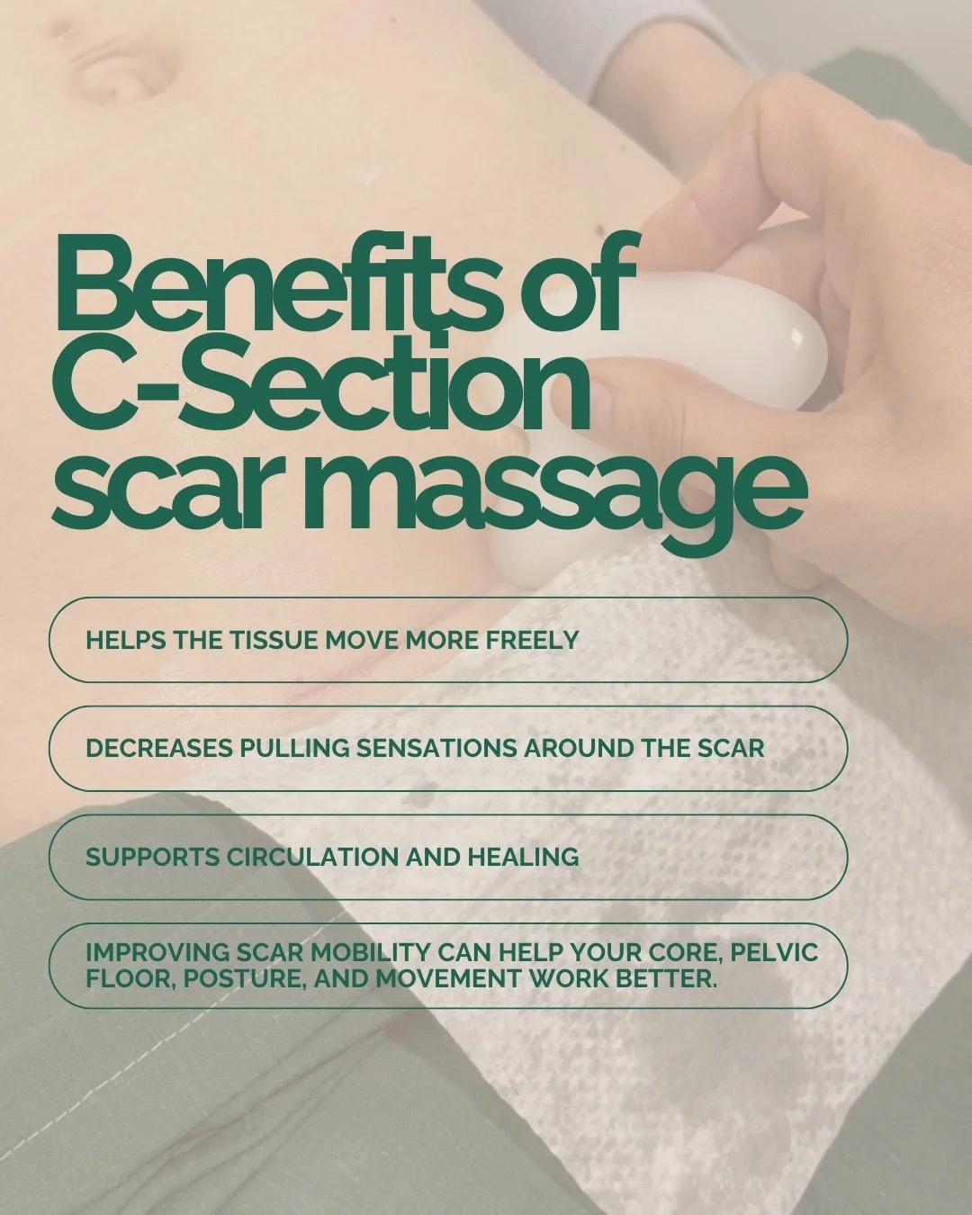 After a C-section, the body goes through an incredible healing process. As the incision heals, scar tissue forms &mdash; and sometimes that tissue can feel tight, restricted, or uncomfortable.

Gentle scar massage can help support the healing process