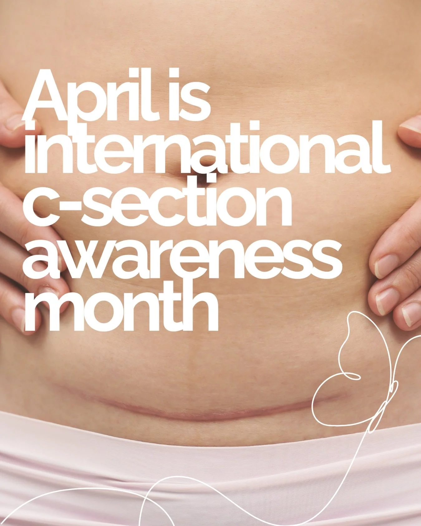 April is International C-Section Awareness Month 

Recovery is more than skin deep. This month we&rsquo;re talking about what actually supports healing beyond just the scar.

💛 Follow along this month for support, education, and guidance. 

#csectio