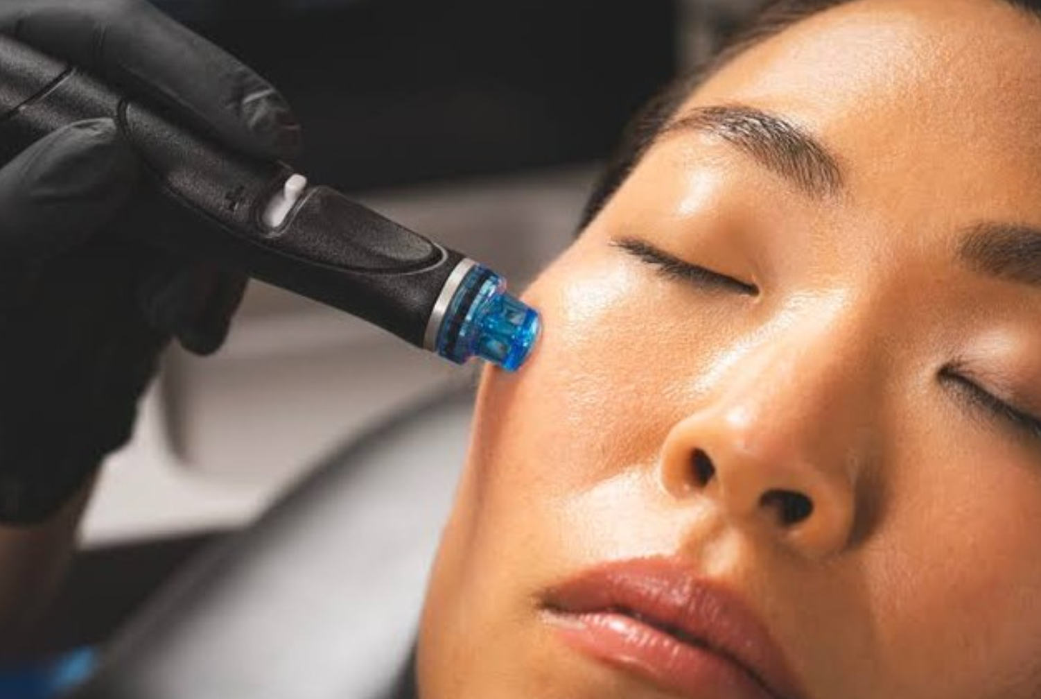 HydraGenesis Warrnambool: The Facial That Deeply Cleanses, Hydrates and Rejuvenates Skin