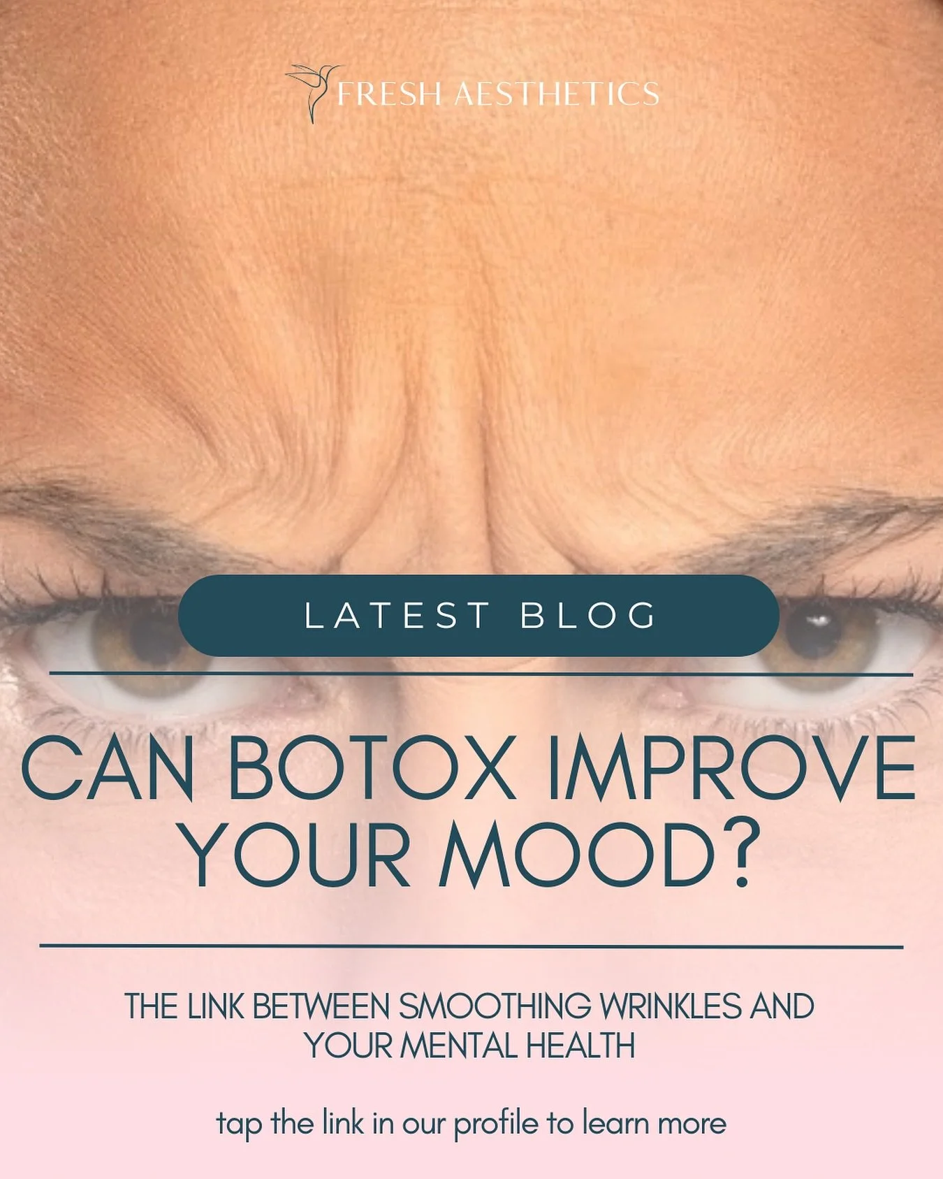 🪞Did you know your skin mirrors how you feel inside?

😕A permanently creased brow. A constant frown. People always telling you that you look tired.

🔬In our latest blog we explore how smoothing out those lines doesn&rsquo;t just refresh your face,