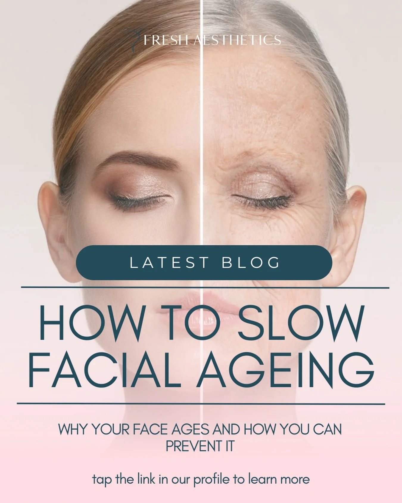 &ldquo;Why am I seeing these age spots and lines &amp; wrinkles?&rdquo; This is a common question we hear in clinic, often after looking at their reflection under an unforgiving light! 

While we tend to blame the passing years, science tells a more 