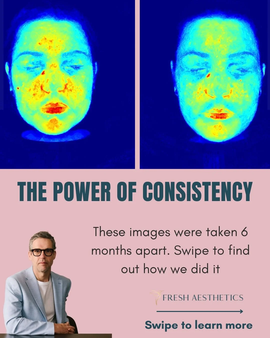 Our patients all receive a bespoke Skin Plan, where we identify gaps in their current skincare regimen &amp; recommended products to help them up their game!

Through our skin partners @getharley, we keep in close contact with our patients as their s