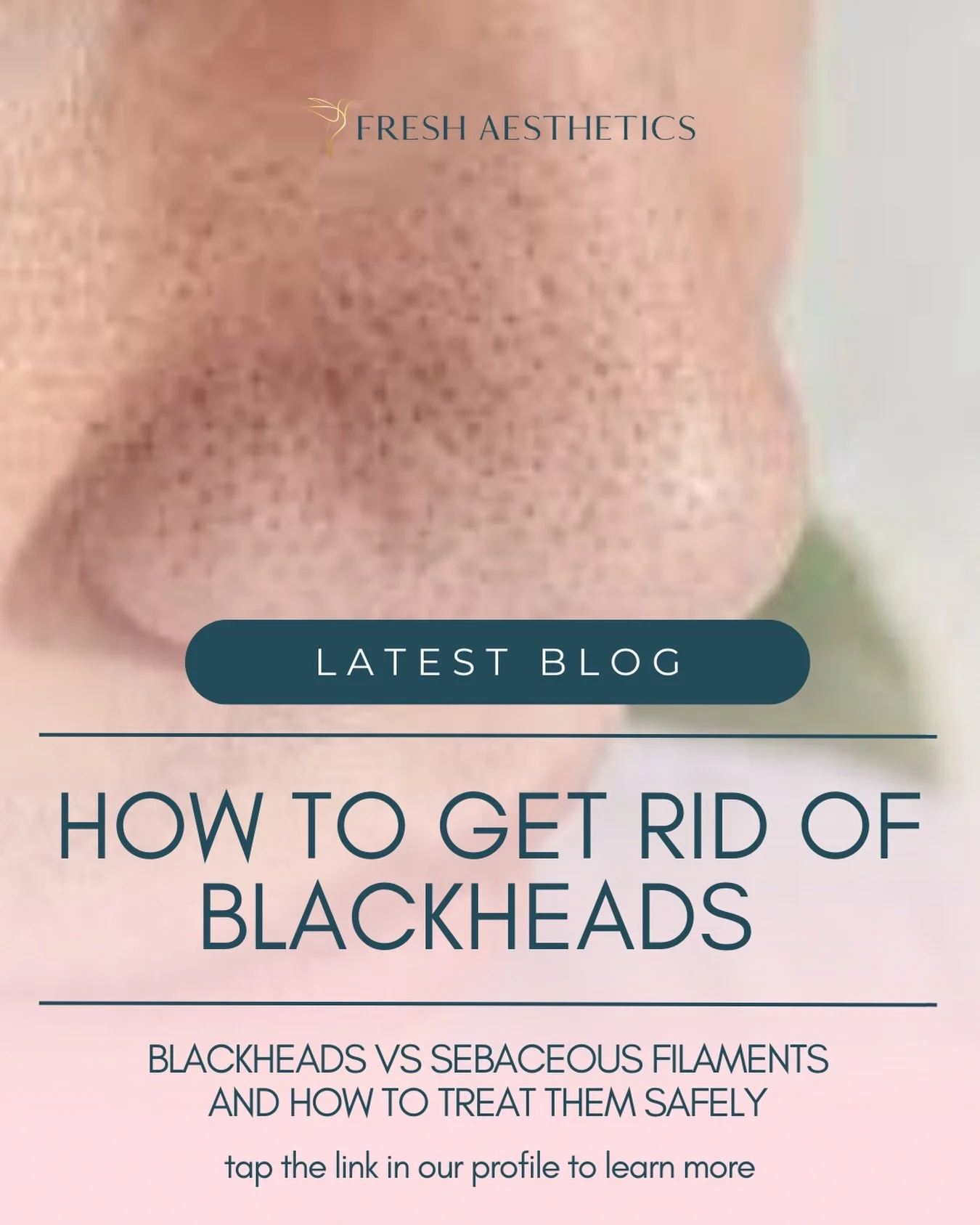 ⚫️ If you find blackheads frustrating, our latest blog is for you. 

⚫️It clearly explains the difference between true blackheads and sebaceous filaments, and why treating them the same way can lead to irritation, congestion, and barrier damage.

⚫️Y