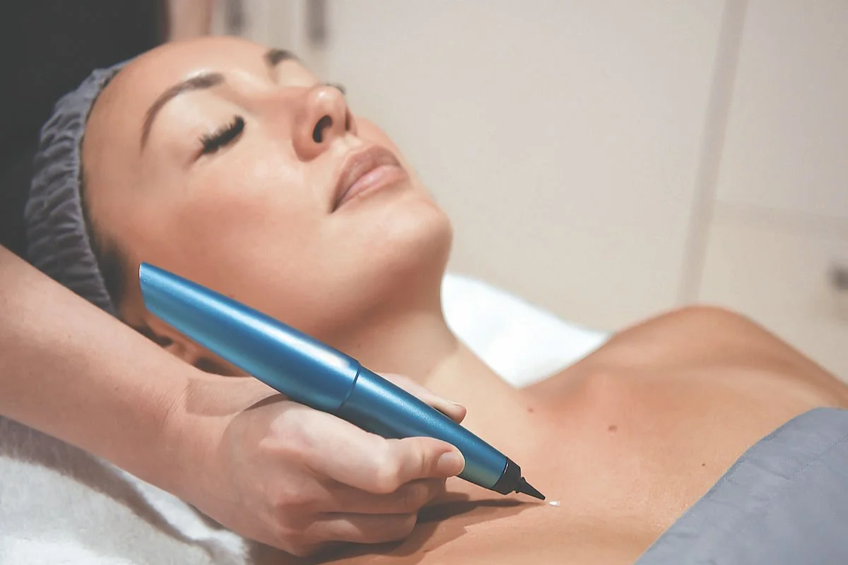 Skin Tag &amp; Brown Spot Removal with CryoPen: How It Works &amp; Does it Hurt?