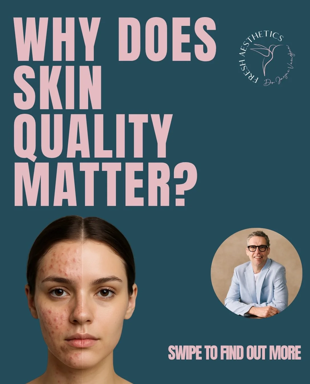 🤔Skin quality is poorly understood and greatly underestimated. Patients often think looking &ldquo;fresh&rdquo; is about reducing wrinkles, but in reality it&rsquo;s much more than that. 

✨When your skin is well hydrated and even in texture &amp; t