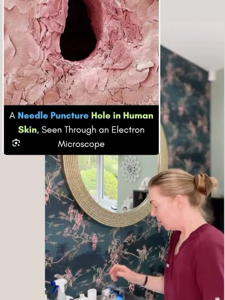 🦠Infection post procedure is rare, but a risk of injectable procedures nonetheless. While we can&rsquo;t eliminate this risk altogether, we can greatly reduce it. But we need your help! 

‼️Always come to clinic completely makeup free, and keep it t