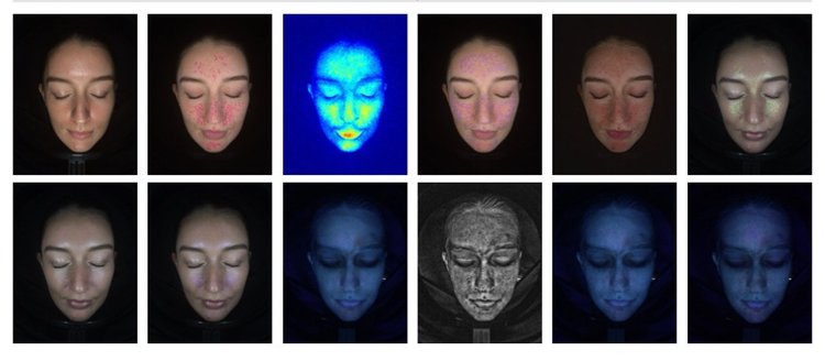 Get to Know your Skin through Digital Skin Analysis — Fresh Aesthetics ...