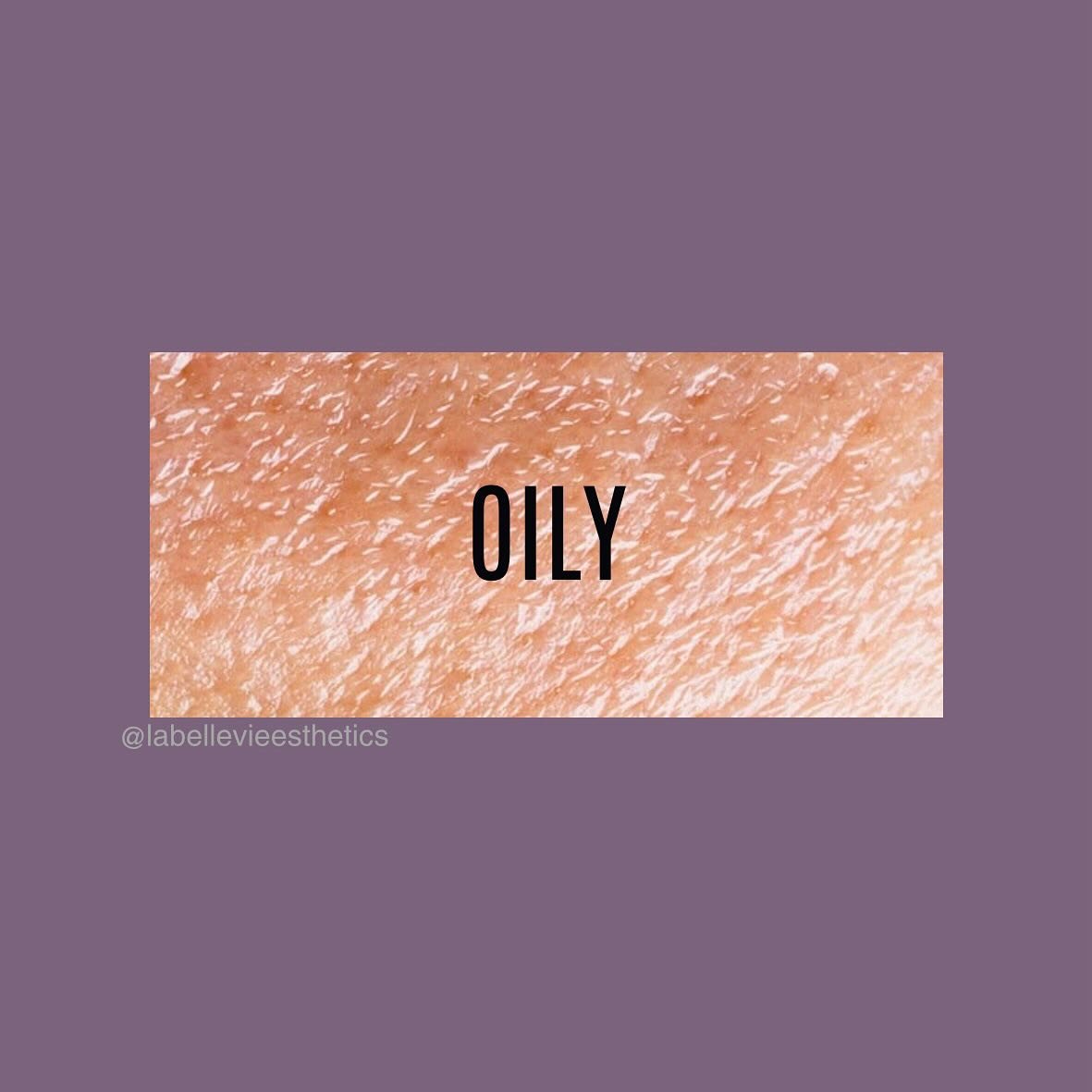 Skin Type #3 - Oily Skin

🧴Moderate to high oil production
🧴Pore and follicle size can become larger here
🧴Appears shiny and may have visible acne or breakouts

#skintype #oilyskin #esthetics #longisland #oil