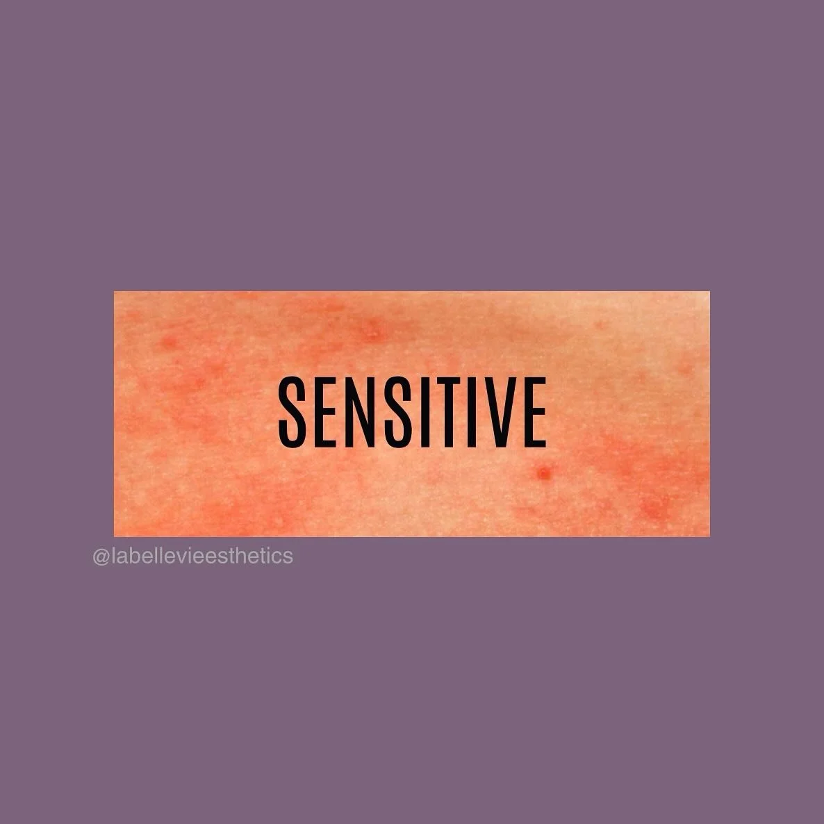Skin Type #5- Sensitive Skin

Sensitive skin isn&rsquo;t considered one of the 4 main skin types but affects many people!

⚠️Environmental factors can enhance skin sensitivity
💥Appears sometimes red, inflamed, or dry

#skintype #senstiveskin skin #e