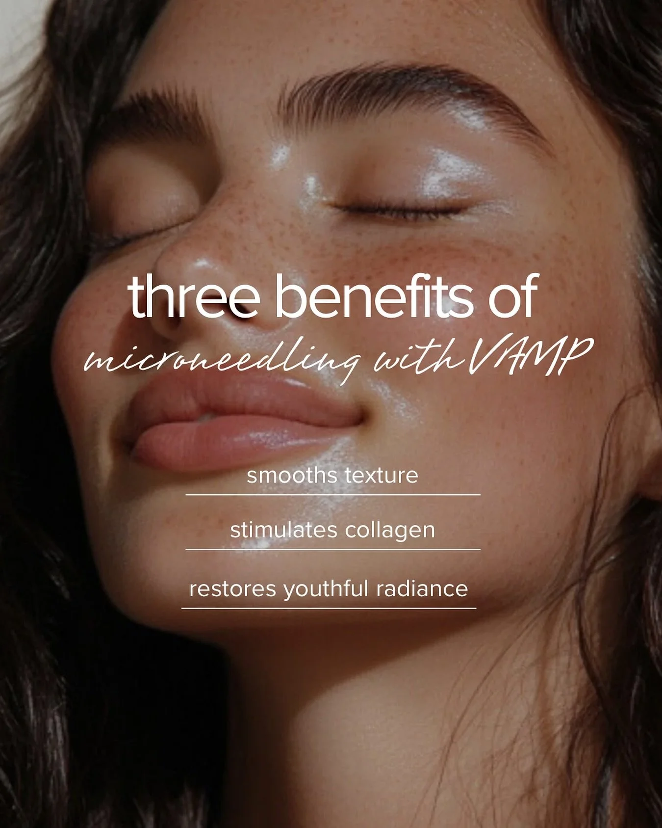 If you struggle with skin texture, fine lines and wrinkles&hellip;listen up!

Microneedling with VAMP is a NEW treatment we offer &mdash; it&rsquo;s packed with vitamins, amino acids and minerals. It helps smooth wrinkles, tighten pores, improve tone