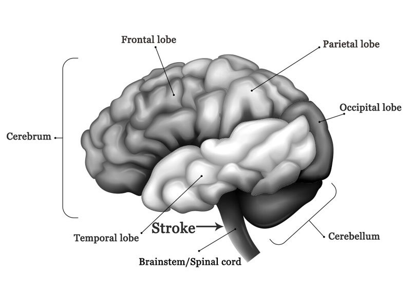 Brainstem street