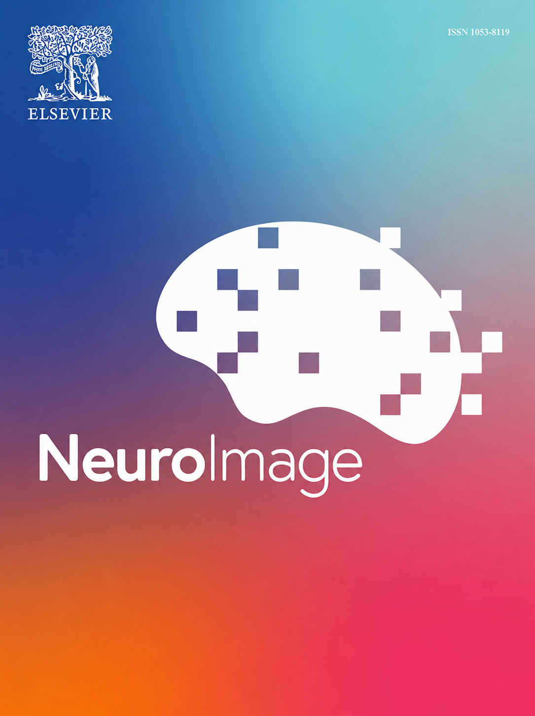 First-in-human evaluation of soft high-density ECoG for epilepsy surgery