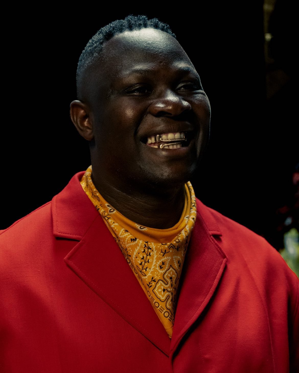 Custom Grillz in Ghana