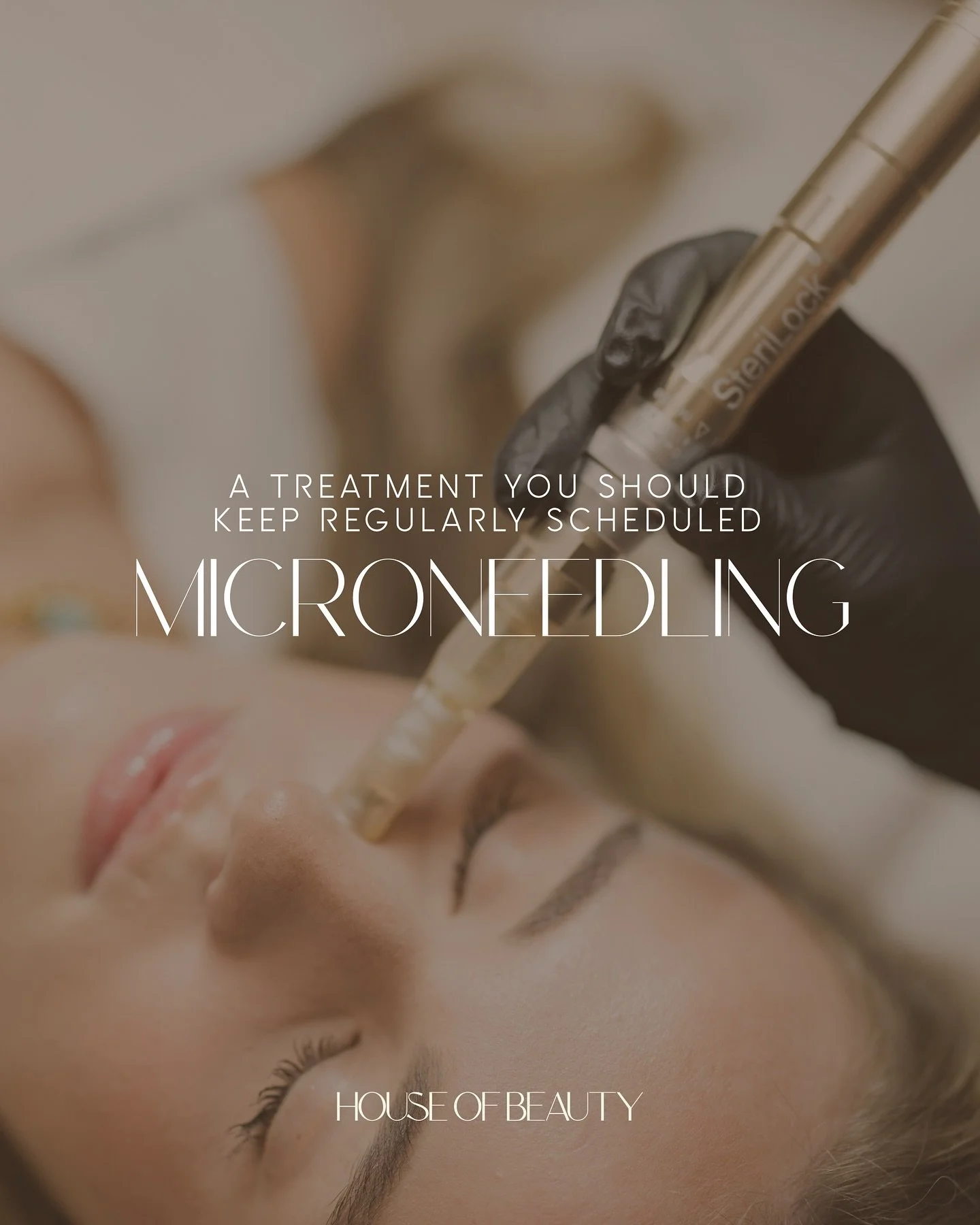 why do we push three? (At least) 

Microneedling in multiple sessions simply gives you the best results.