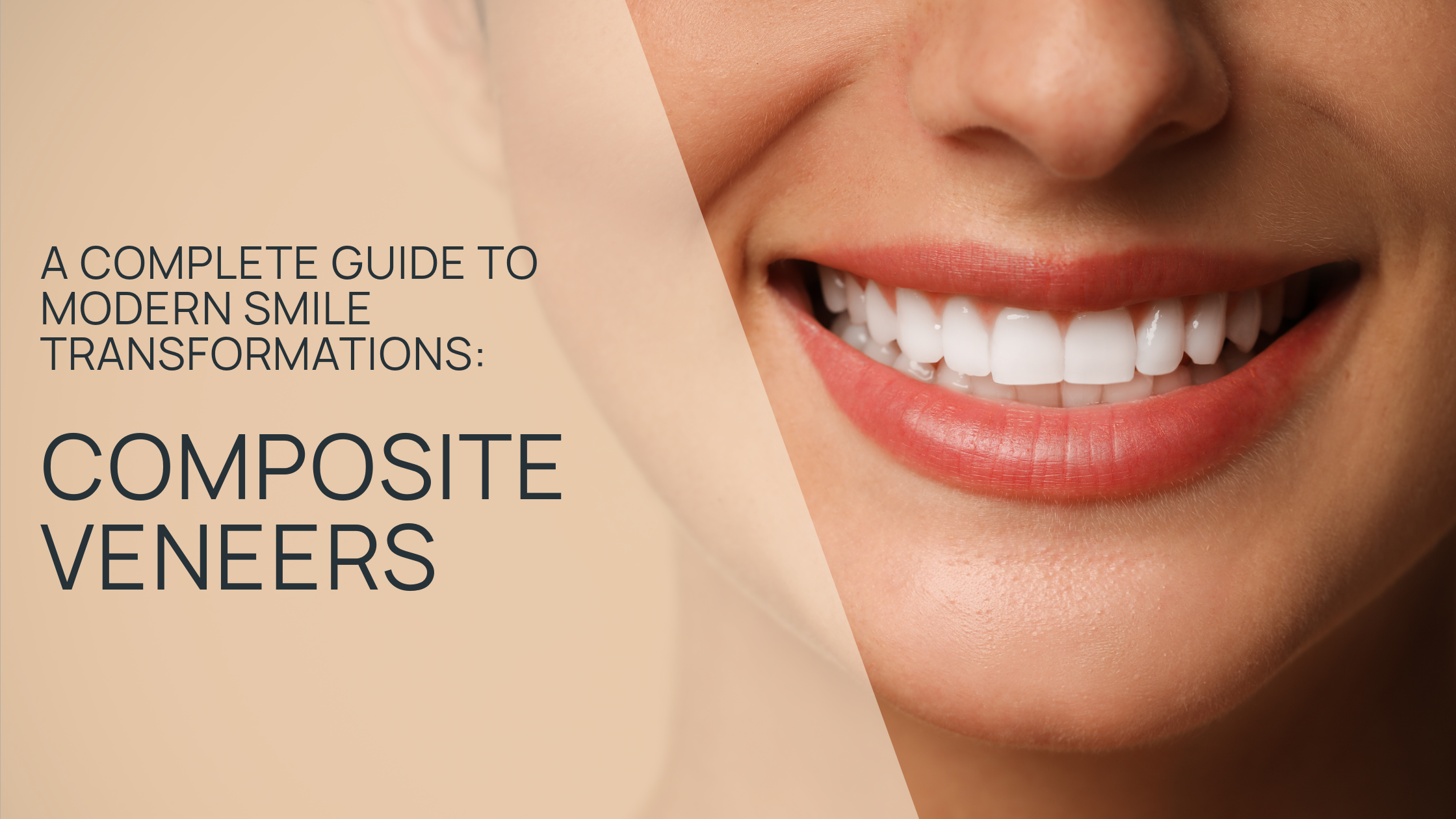Composite Veneers: A Complete Guide to Modern Smile Transformations