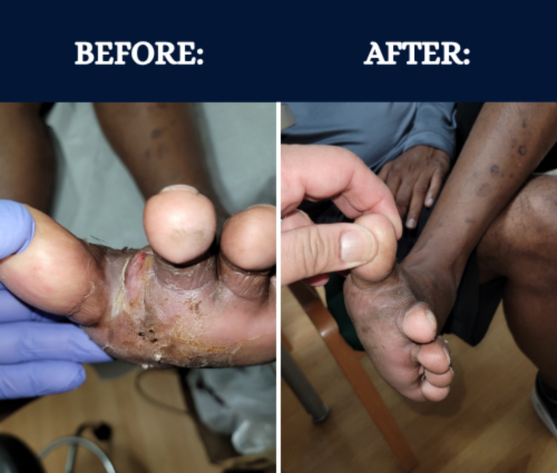 Graphic Wound