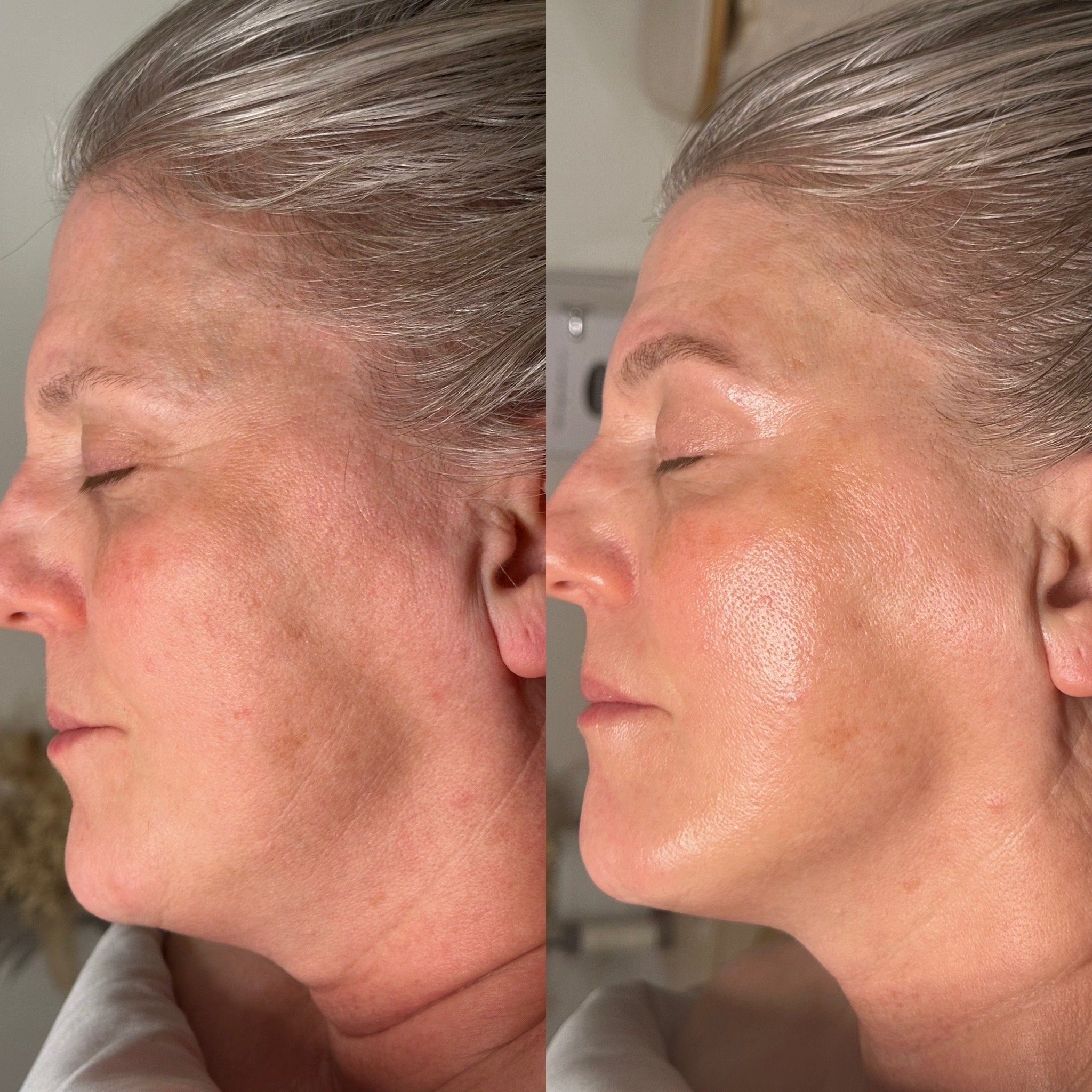 Refine Time + Dermaplaning.jpg