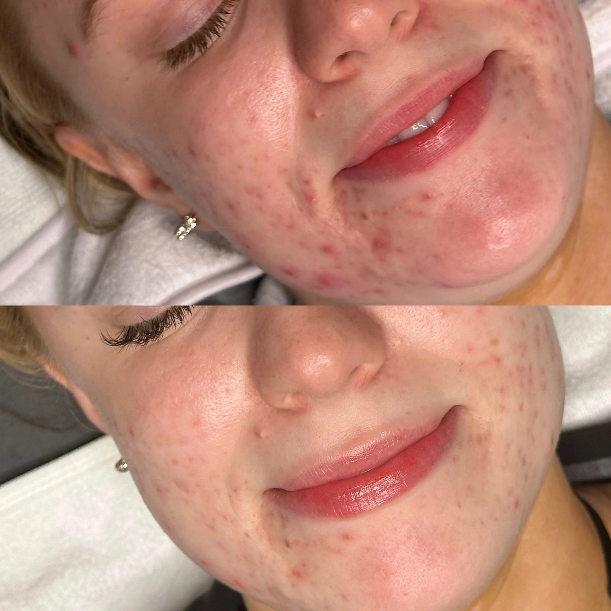 Cellstory One Week Results.jpg