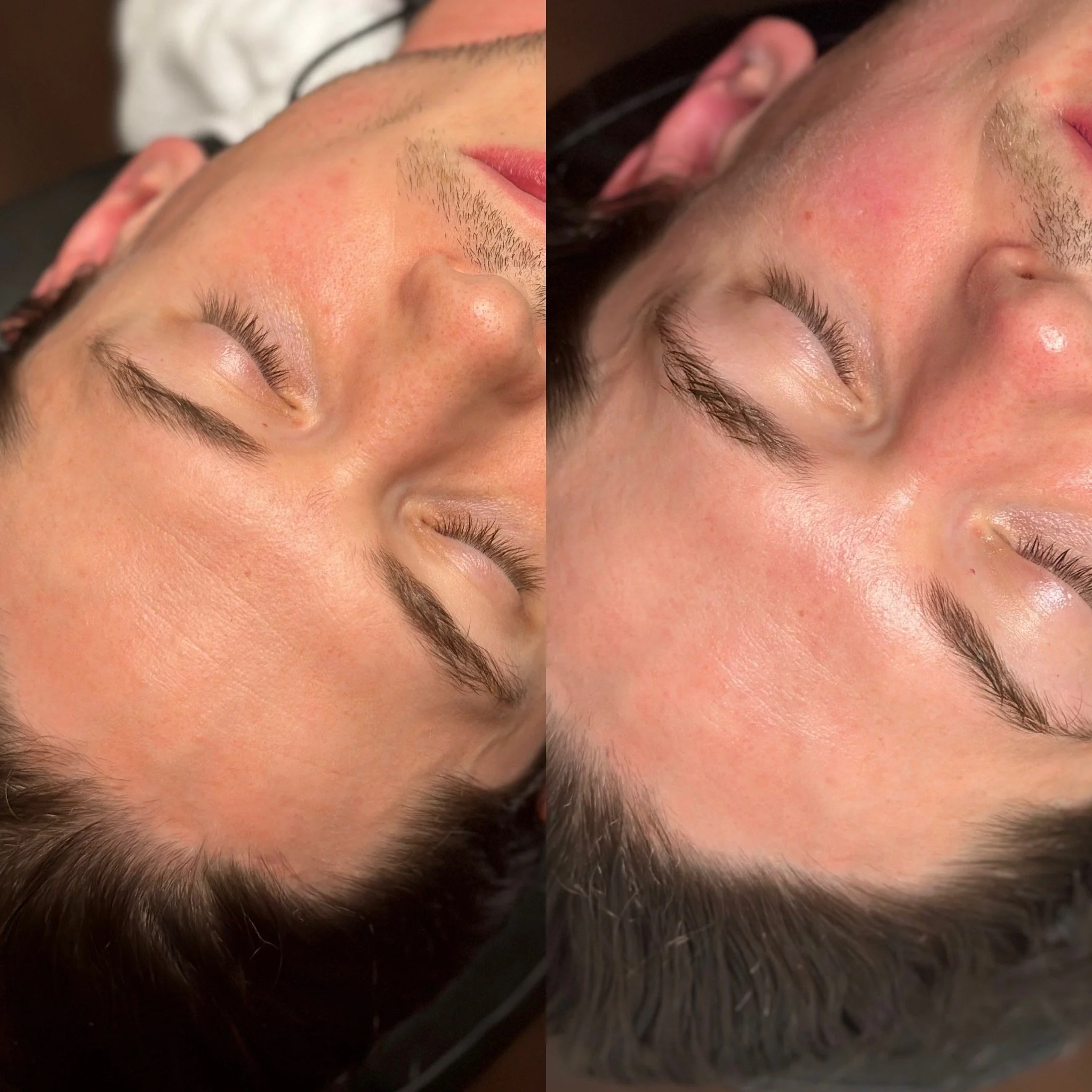 Refine Time Facial .jpg