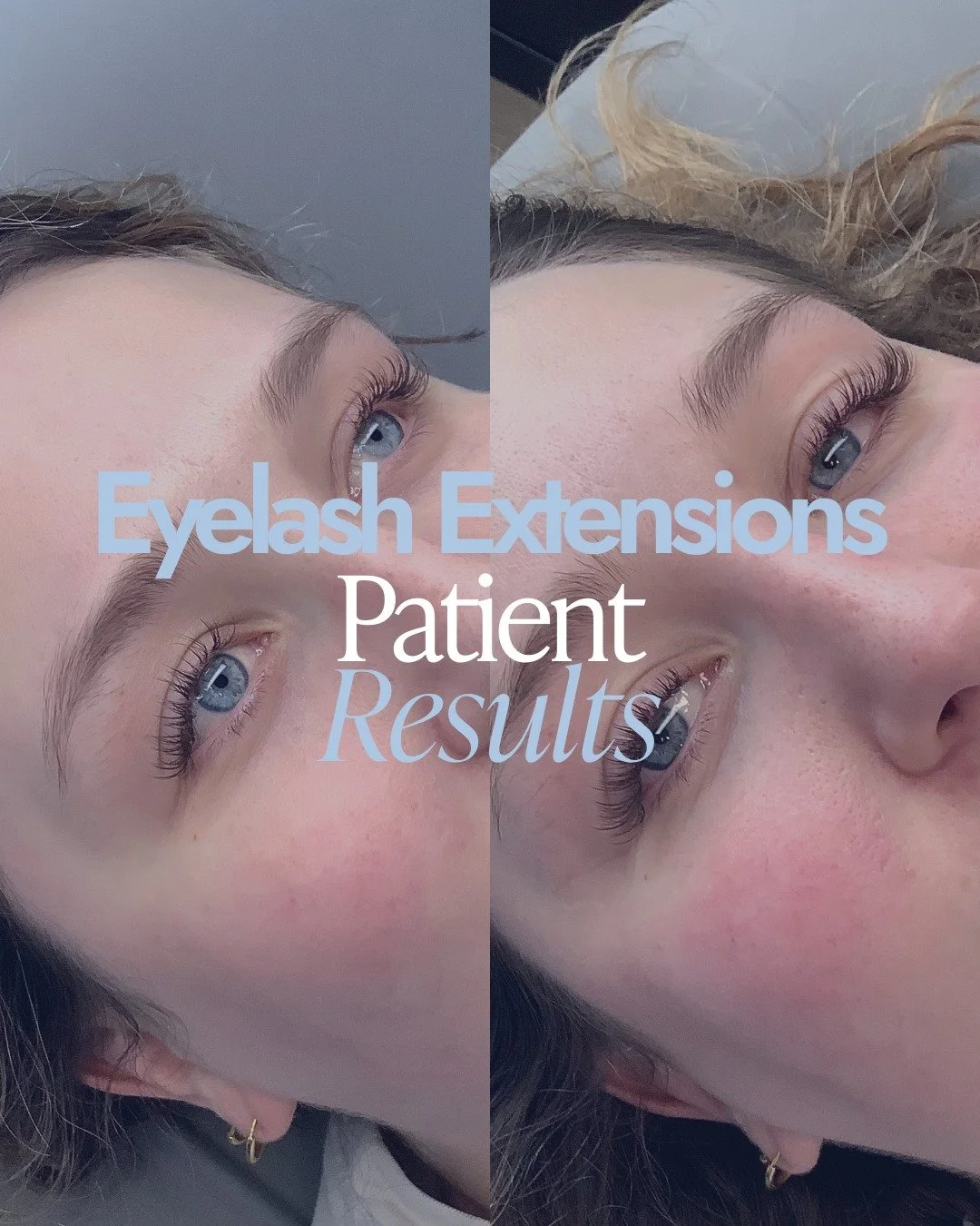 Lash extensions aren&rsquo;t just about looking glam&mdash;they&rsquo;re about waking up ready with eyes that feel bright, open, and effortless. Each set is customized to your natural lashes, giving you fullness, length, and lift without compromising