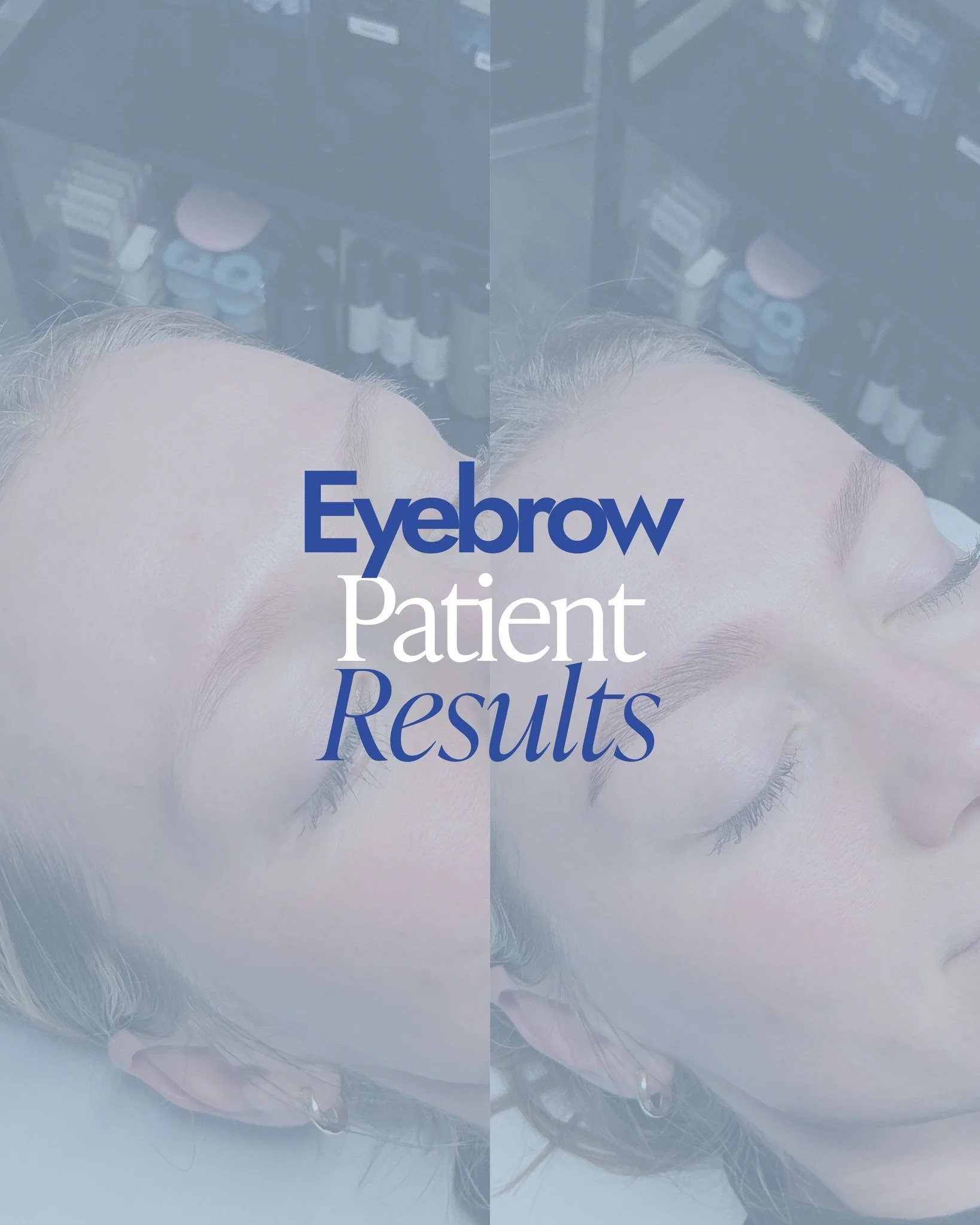 Eyebrow Transformation ✨

Brow tint + lamination for fuller-looking, more defined brows that frame the face beautifully 🤍