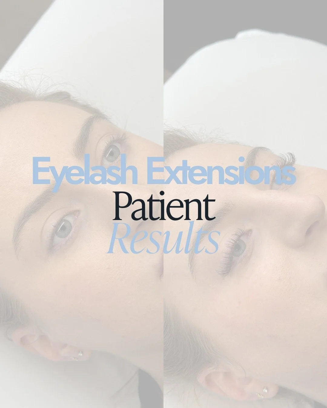 From natural to noticeable &mdash; without a single swipe of mascara.
Lash extensions enhance what&rsquo;s already yours, adding length and fullness in a way that still feels effortless and you.

✨ Eyes look brighter
✨ Mornings feel easier
✨ Confiden