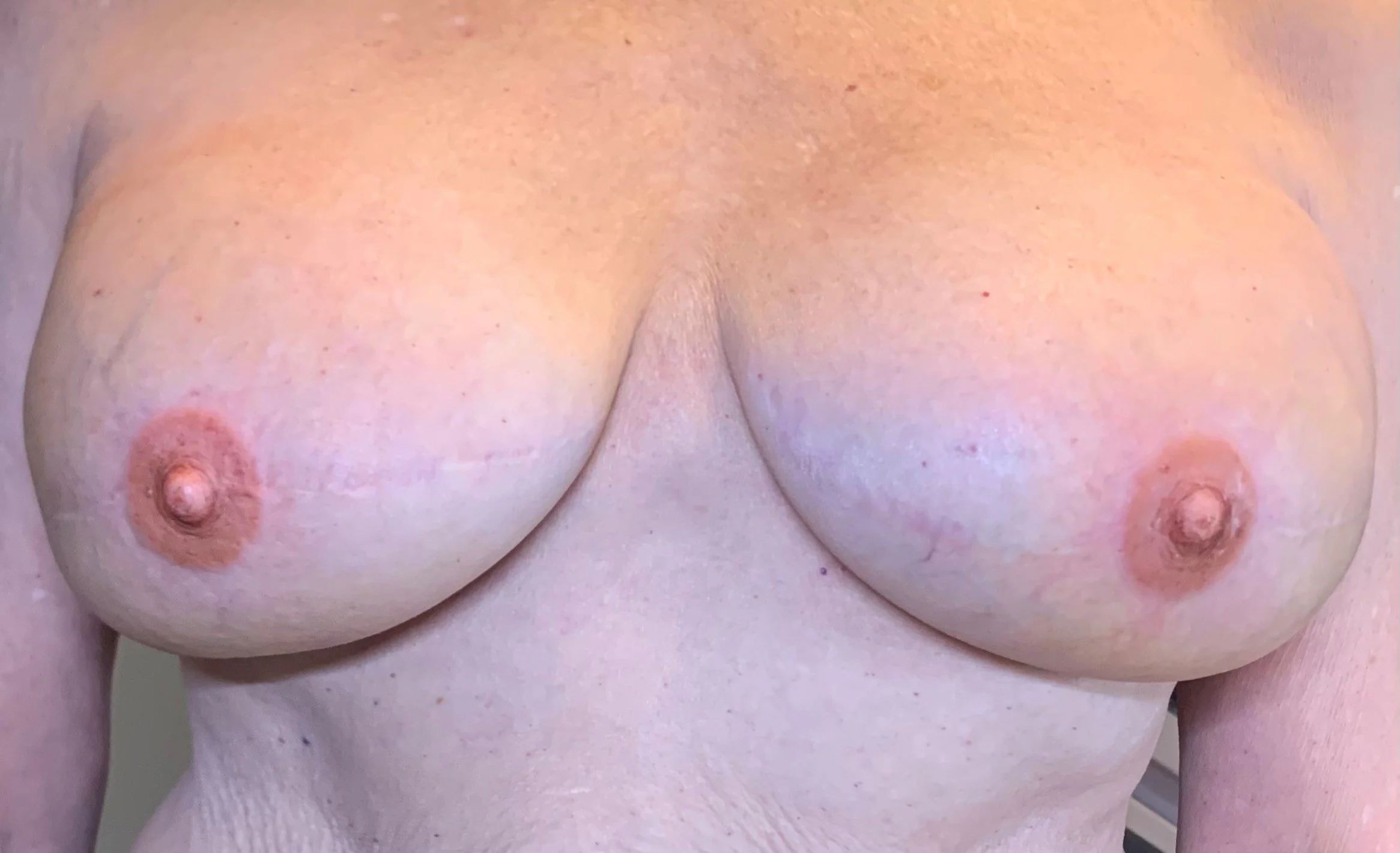 Immediately After Tattoo