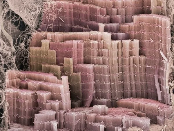 human skeletal muscle fibers