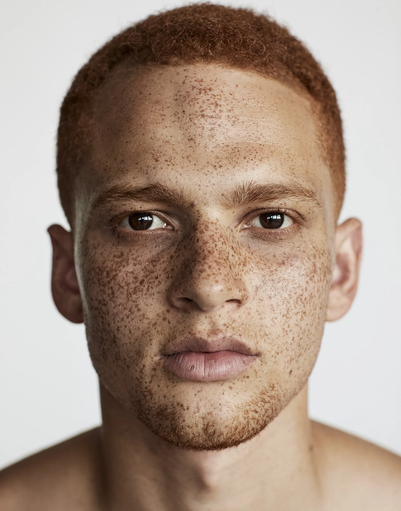Unretouched skin close-up — freckles and natural detail