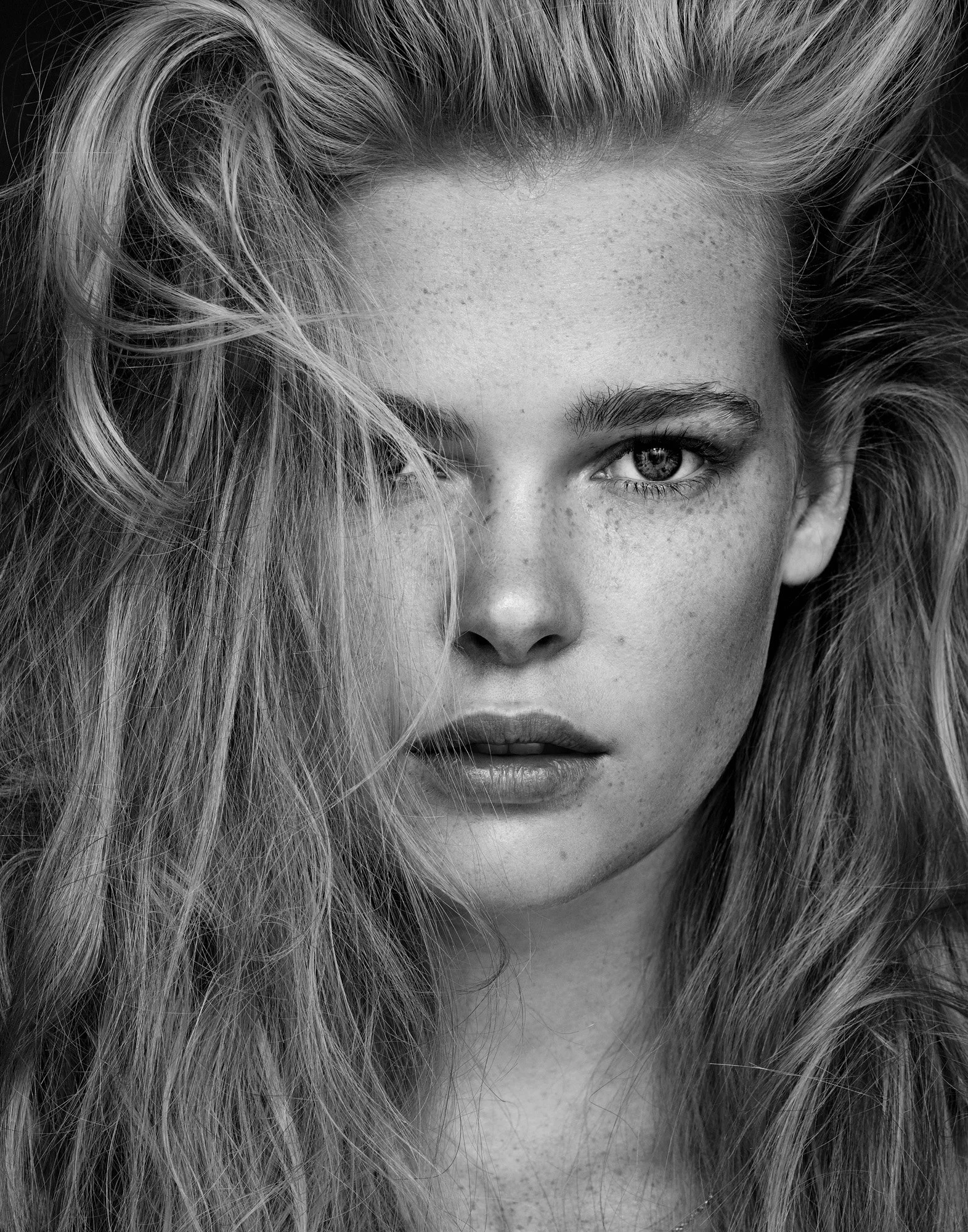 The Skin Series - Freckles